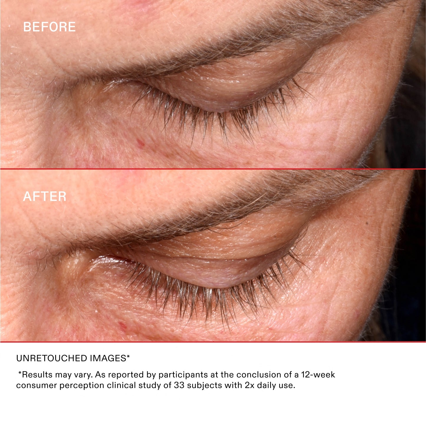 UNRETOUCHED IMAGES*
*Results may vary. As reported by participants at the conclusion of a 12-week consumer perception clinical study of 33 subjects with 2x daily use.